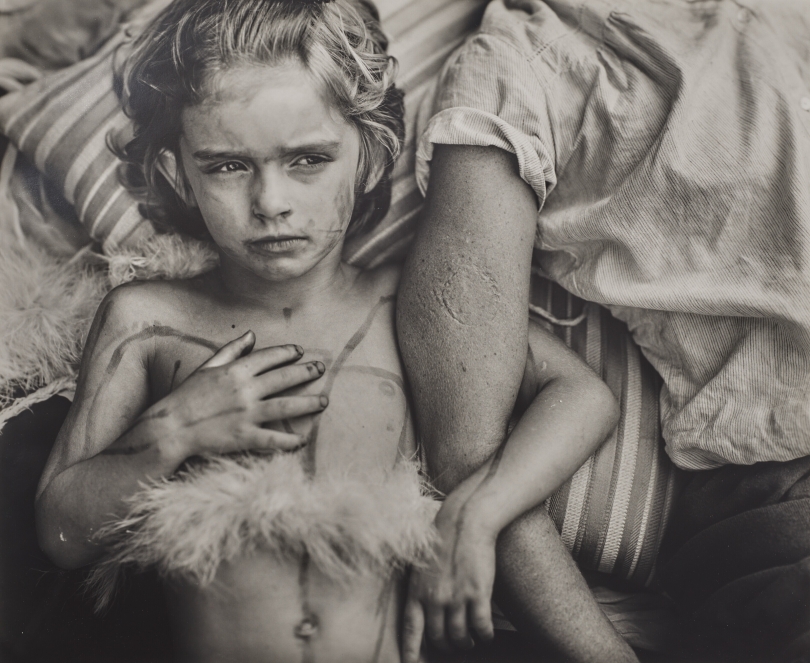 Sally Mann, Jessie Bites, 1985